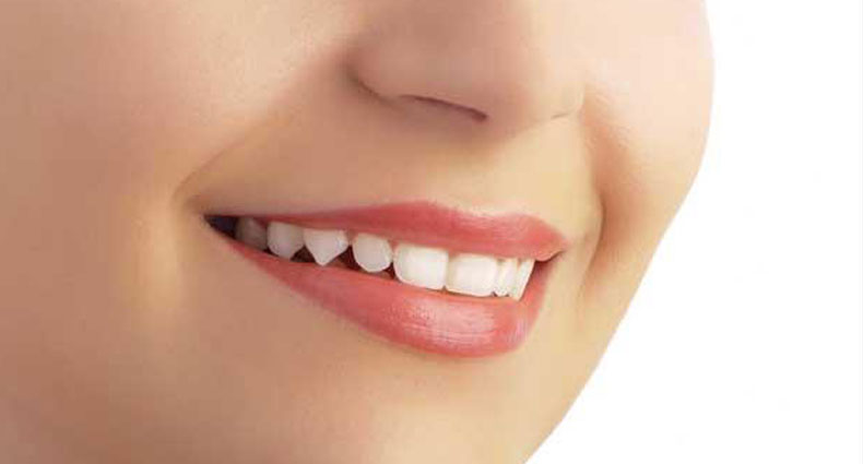 ঠোঁটকে সুন্দর ও আকর্ষণীয় করতে করণীয় কিছু টিপস্