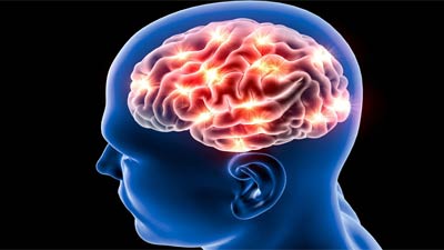 ব্রেন স্ট্রোকের ঝুঁকি এড়াতে দাঁত পরিষ্কার রাখুন!