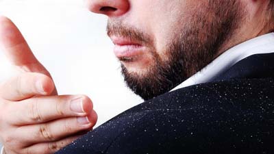 চুলে খুশকি? জেনে নিন দূর করার কৌশল