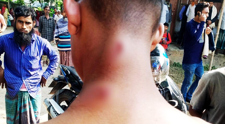 পরীক্ষার ফি দিতে না পারায় বাটাম দিয়ে পিটালেন মাদরাসার অধ্যক্ষে 