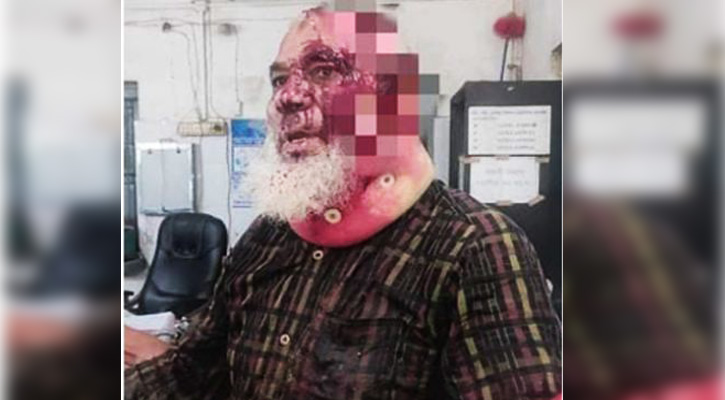 বীর মুক্তিযোদ্ধাকে কোপালেন পৌর মেয়র