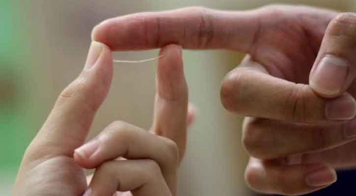 গলায় কাঁটা ফুটলে কী করবেন?