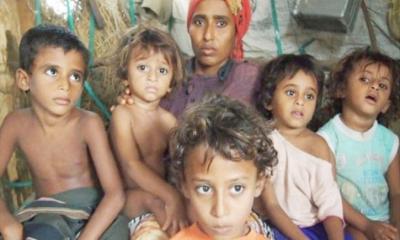 পুষ্টিহীনতার চরম পর্যায়ে ইয়েমেনের লাখো শিশু
