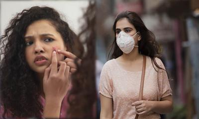 মাস্ক ব্যবহারে কি ব্রণ হতে পারে?