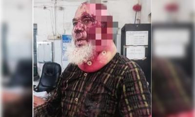 বীর মুক্তিযোদ্ধাকে কোপালেন পৌর মেয়র