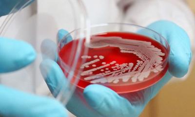 অ্যান্টিবায়োটিকের ভুল ব্যবহারে সুপারবাগের শঙ্কা