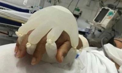 স্পর্শের সুখ দিতে নার্সের অভিনব পন্থায় তাজ্জব পৃথিবী