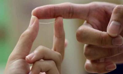 গলায় কাঁটা ফুটলে কী করবেন?