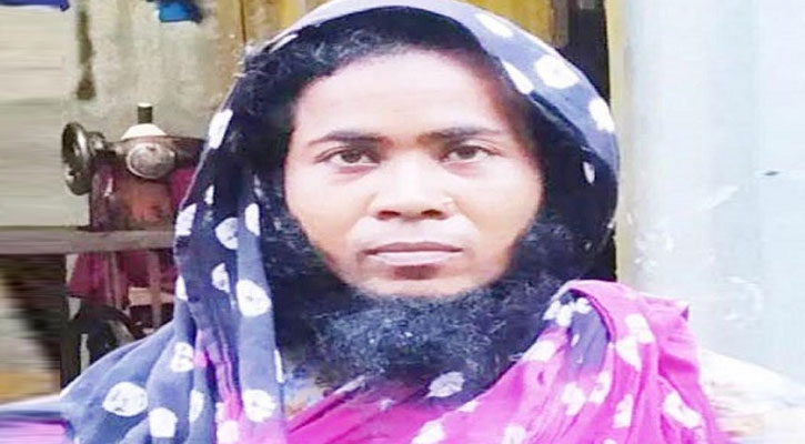নারীর মুখে পুরুষের মতো দাড়ি, এলাকায় তোলপাড়