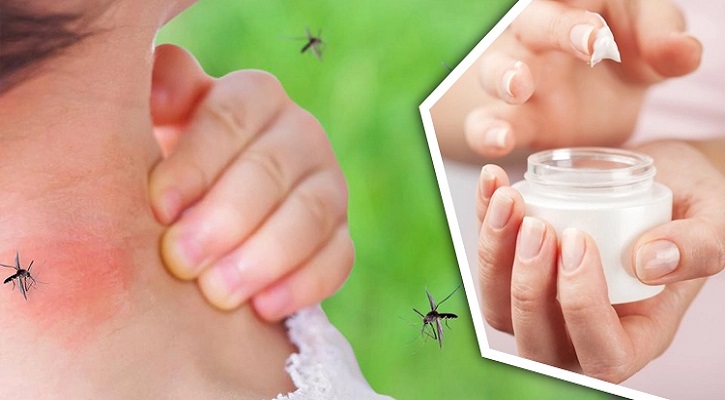 মশা তাড়ানোর ক্রিম তৈরি করুন ঘরেই