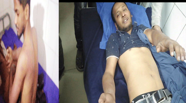 বেগমগঞ্জে চোর সন্দেহে চার যুবককে মধ্যযুগীয় কায়দায় নির্যাতনের অভিযোগ