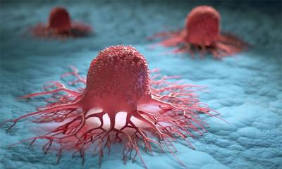 প্রথম ট্রায়ালেই একসঙ্গে ক্যানসার মুক্ত ১৮ রোগী!