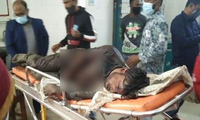 আ.লীগ কর্মীদের কোপে ‘হাতের কবজি’ হারালেন যুবলীগ নেতা