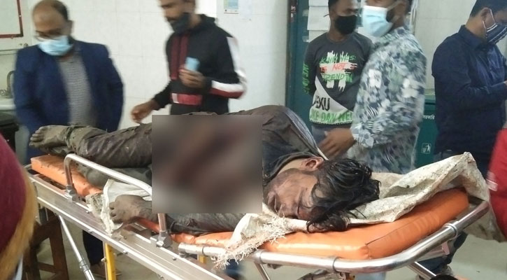 আ.লীগ কর্মীদের কোপে ‘হাতের কবজি’ হারালেন যুবলীগ নেতা