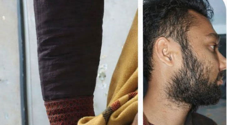 নোয়াখালীতে এনসিপির নেতার উপর হামলা