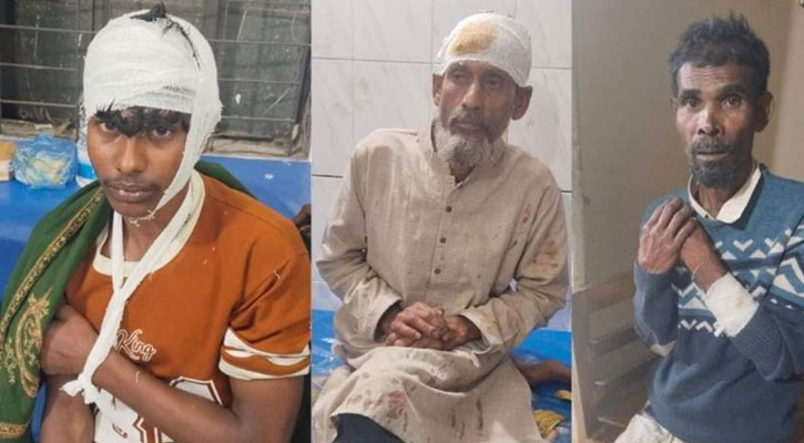আওয়ামী লীগ নেতাদের হামলায় বিএনপির ৫ নেতাকর্মী আহত