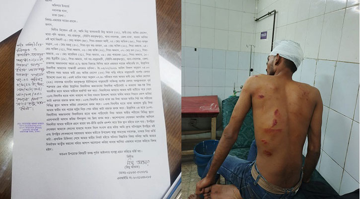 নবাবগঞ্জে হ্যা ভোটের ক্যাম্পেইনারকে কুপিয়ে জখম করল যুবদল নেতা