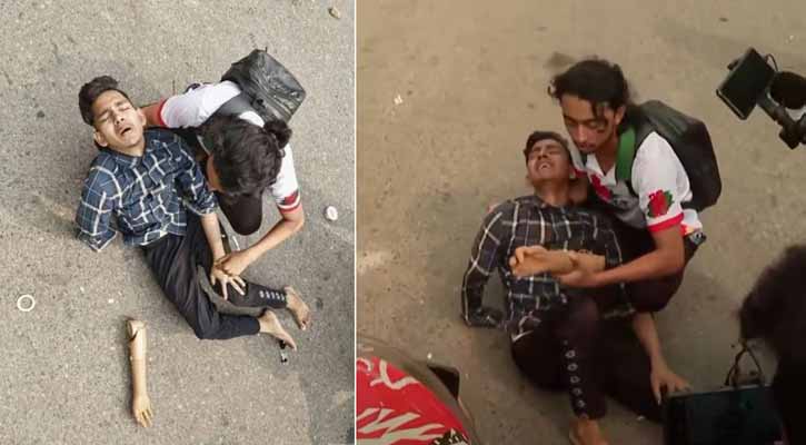 পুলিশের সাথে সংঘর্ষ: রাস্তায় পড়ে রইল জুলাই যোদ্ধার কৃত্রিম হাত