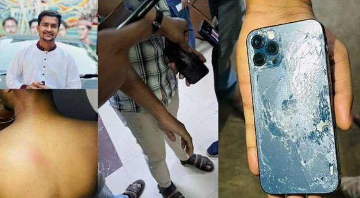 থানায় জিডি করতে গিয়ে পুলিশের পিটুনির শিকার ঢাবি শিক্ষার্থী