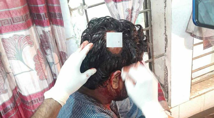 ইট দিয়ে সহকারী শিক্ষকের মাথা ফাটালেন যুবদল নেতা! 