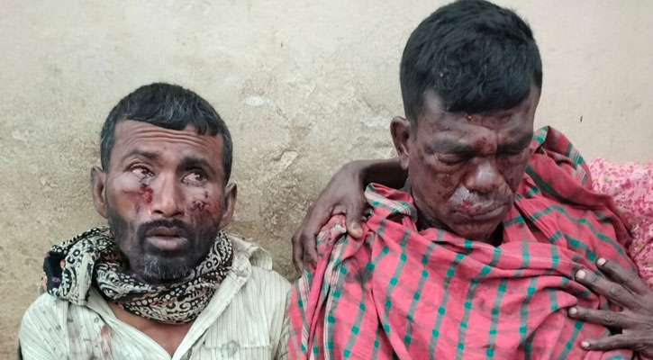 যশোরে মাটি কাটার সময় বোমা বিস্ফোরণে দুই শ্রমিক গুরুতর আহত