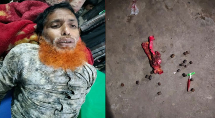 আধিপত্যের দ্বন্দ্বে মাগুরার শ্রীপুরে রণক্ষেত্র, আহত কয়েকজন