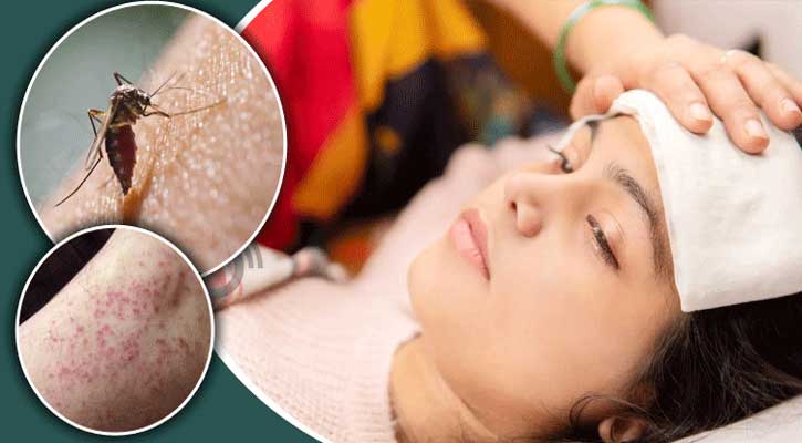 ডেঙ্গু নিয়ে ৫ বার্তা দিলো স্বাস্থ্য মন্ত্রণালয়