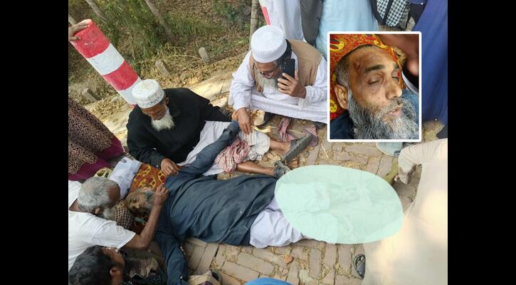 পাথরঘাটায় জামায়াত নেতার দুই পা ভেঙে দেওয়ার অভিযোগ