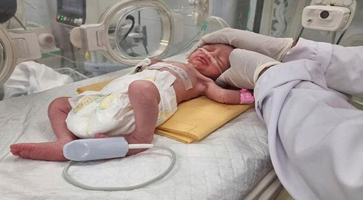 মারা গেল ফিলিস্তিনি মৃত মায়ের গর্ভ থেকে জন্ম নেয়া শিশুটি