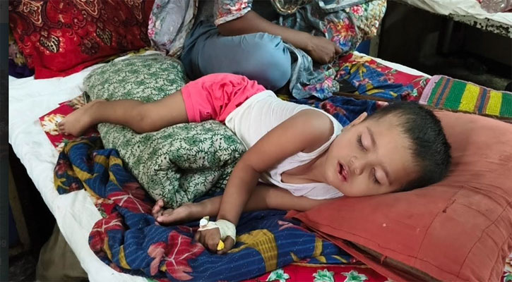 হামে আরও ৭ শিশুর মৃত্যু, শনাক্ত ১৬৩১