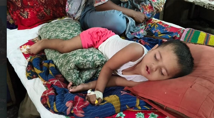 হাম ও উপসর্গে প্রাণ গেল আরও ১৩ জনের, মৃত্যু ছাড়াল ৫০০