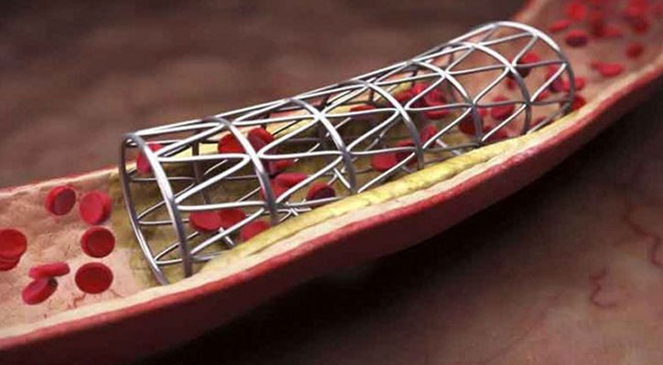 আবারও কমলো হার্টের রিংয়ের দাম