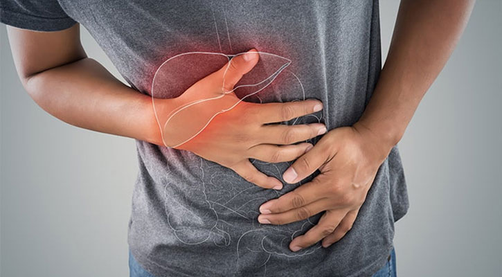 পিত্তথলিতে পাথর: উপসর্গ, কারণ ও প্রতিরোধ