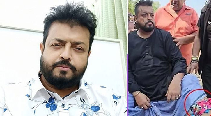 শুটিংয়ে সাপের কামড়ে আহত ওমর সানী