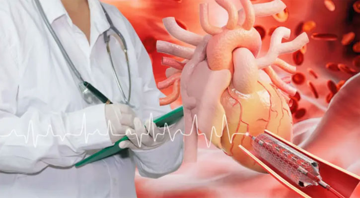 হার্টের চিকিৎসায় ব্যবহৃত ‘রিং’ এর দাম কমালো সরকার