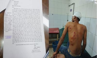 নবাবগঞ্জে হ্যা ভোটের ক্যাম্পেইনারকে কুপিয়ে জখম করল যুবদল নেতা