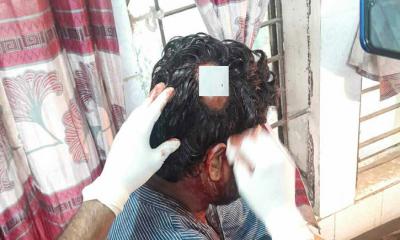 ইট দিয়ে সহকারী শিক্ষকের মাথা ফাটালেন যুবদল নেতা! 