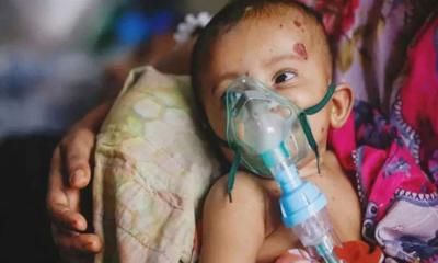 উপসর্গসহ হামে প্রাণ হারালো আরও ৮ শিশু, আক্রান্ত ১৫৬৪