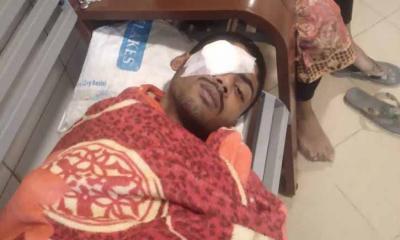 রূপগঞ্জে মুক্তিপণ না পেয়ে কলেজছাত্রকে চোখ উপড়ে হত্যা চেষ্টা