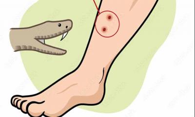 নেত্রকোনায় সাপের কামড়ে ছয় বছরের শিশুর মৃত্যু