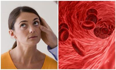 রক্তশূন্যতায় ভুগছেন কিনা বুঝবেন কীভাবে?