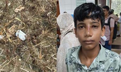শরীয়তপুরে খেলনা বল ভেবে ককটেল হাতে, বিস্ফোরণে আহত কিশোর