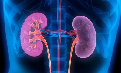 ৫ লক্ষণে বুঝে নিন কিডনির অসুস্থতা