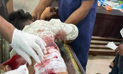 রূপগঞ্জে রাজনৈতিক কোন্দলে ফার্মেসিতে গুলিবর্ষণ, গার্মেন্টস শ্রমিক গুলিবিদ্ধ