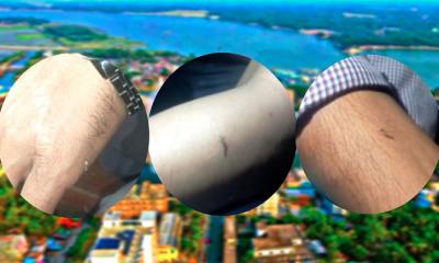 বরিশালে মশার উপদ্রবে অতিষ্ঠ নগরবাসী, জনদূর্ভোগ চরমে