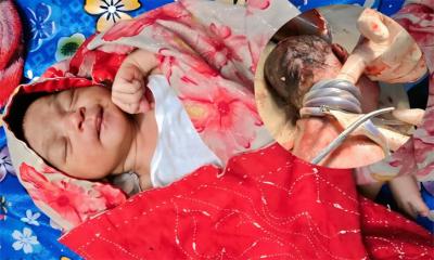 বরগুনায় চার প্যাঁচে জড়নো নবজাতকের জন্ম