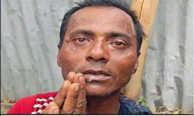 বখাটের হাত কামড়ে রক্ষা পেলো স্কুলছাত্রী
