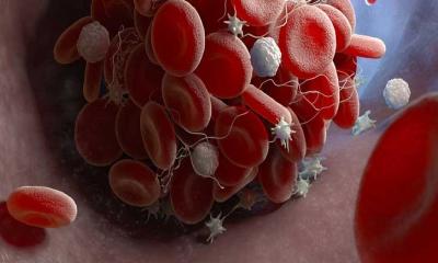 কীভাবে বাড়াবেন রক্তের প্লাটিলেট?