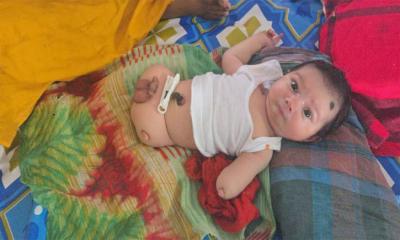 পিরোজপুরে হাত-পা বিহীন শিশুর জন্ম, গ্রহণ করতে পিতার অস্বীকৃতি