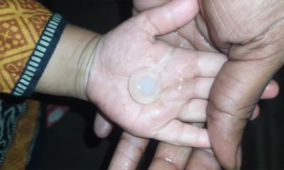 কুমিল্লায় অস্বাভাবিক শিলাবৃষ্টি, এলাকায় চাঞ্চল্য